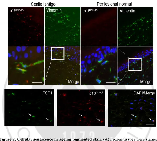 Figure 2. Cellular senescence in ageing pigmented skin. (A) Frozen tissues were stained 