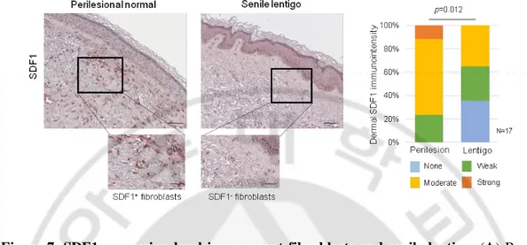 Figure  7.  SDF1  expression  level  in  senescent  fibroblasts  and  senile  lentigo