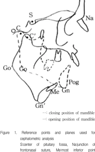 Figure  1.  Reference  points  and  planes  used  for  cephalometric  analysis