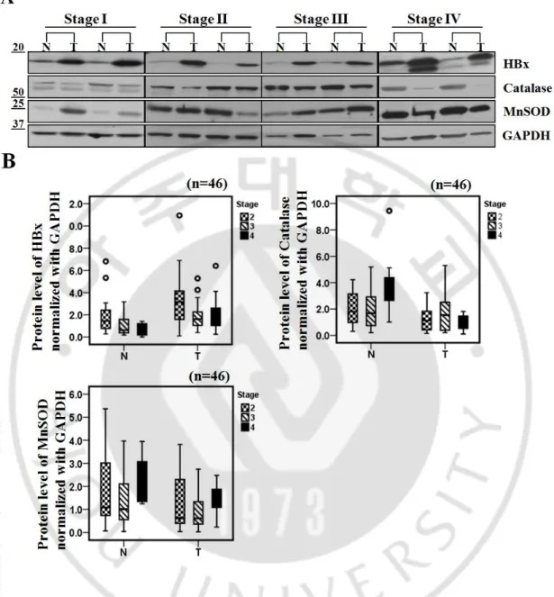 Fig. 8. Catalase expression level is significantly lower in HBV-related advanced HCC. (A) 