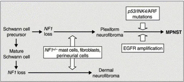 Fig.  4.  Models  of  tumorigenesis  and  tumor  development  in  NF1  (Dasgupta  B,  et  al.,  2003)