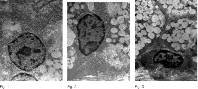 Fig.  1. Fig.  2. Fig.  3.