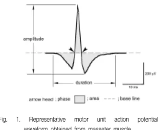 Fig.  1.  Representative  motor  unit  action  potential  waveform  obtained  from  masseter  muscle.