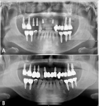 Fig. 6. Case 2: Panoramic radiograph at the first visit.