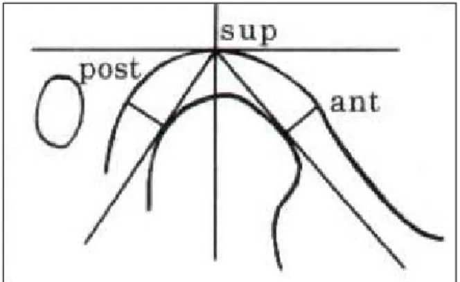 Fig.  3.  The  reference  plane  and  three  spaces  of  TMJ 
