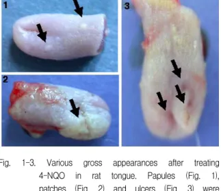 Fig.  1-3.  Various  gross  appearances  after  treating  4-NQO  in  rat  tongue.  Papules  (Fig