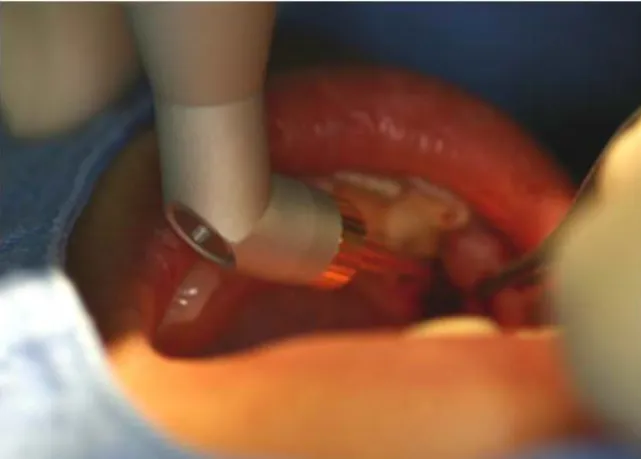 Fig.  1.  Pre-operation