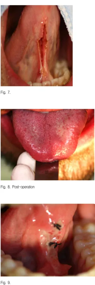 Fig.  8.  Post-operation