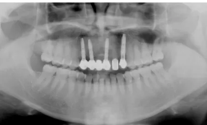 Fig. 10. Panoramic view after final restoration setting.