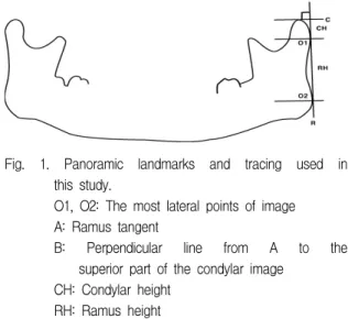 Fig.  1.  Panoramic  landmarks  and  tracing  used  in  this  study.