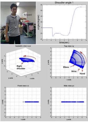Fig.    6. Simulation results of the first shoulder joint in MATLAB. 