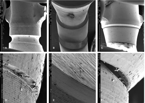 Fig. 2. CAD-CAM abutment-implant assembly observation using scanning electron microscopy