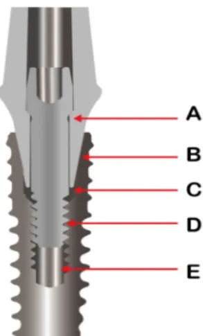 Fig. 8. (A) Old and new screws of the Osstem implant. (B) Interface between the old screw head  and abutment