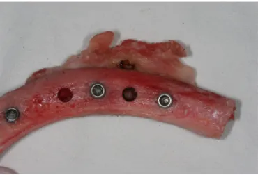 Fig. 1. Dental implants placed into the pork rib after periosteum reflection and drilling according to the  size of dental implant fixture.