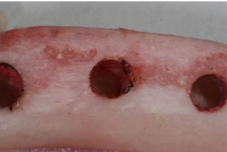 Fig. 4. Thermo-necrosis of the bone at the extraction of implant fixture site in the 40 watt and 40  second group.