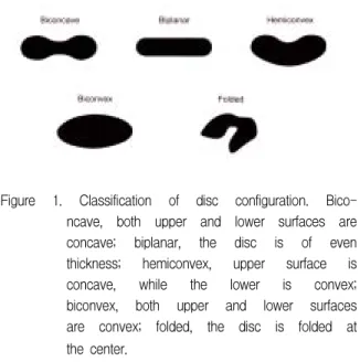 Figure  1.  Classification  of  disc  configuration.  Bico- Bico-ncave,  both  upper  and  lower  surfaces  are  concave;  biplanar,  the  disc  is  of  even  thickness;  hemiconvex,  upper  surface  is  concave,  while  the  lower  is  convex; 