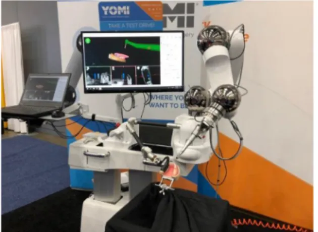 Fig. 1. YOMI Robot-assisted dental surgery system from Neocis, Inc.