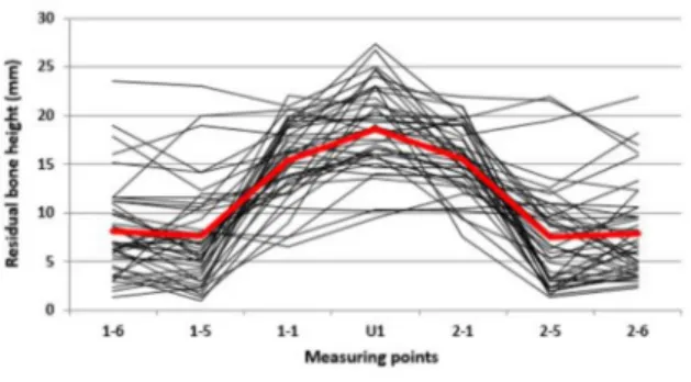 Fig. 1. The residual bone height at the maxillary measure points on computed tomography.