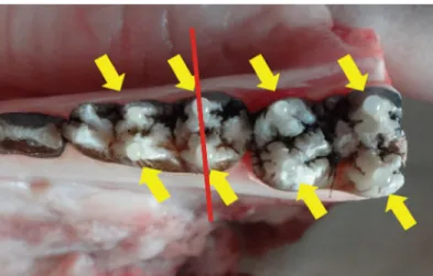Fig. 1. Radiopaque flowable composite markers were attached to the enamel (yellow arrows)