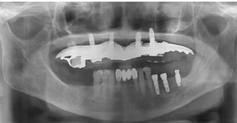Fig. 10. After fixture placement.