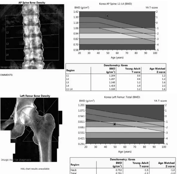 Fig.  4.  Bone  mineral  density  showed  improved  bone  density  of  spine  and  femur  after  the  treatment  (Case  1).