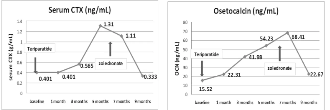 Fig.  3.  Serum  CTX  and  osteocalcin  levels  were  elevated  after  teriparatide  therapy.
