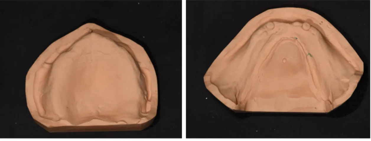 Fig. 6. Master model fabricated.