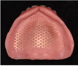 Fig. 10. Intaglio surface of upper denture.