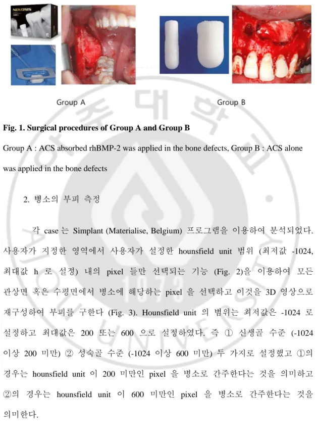 Fig. 1. Surgical procedures of Group A and Group B                                                       
