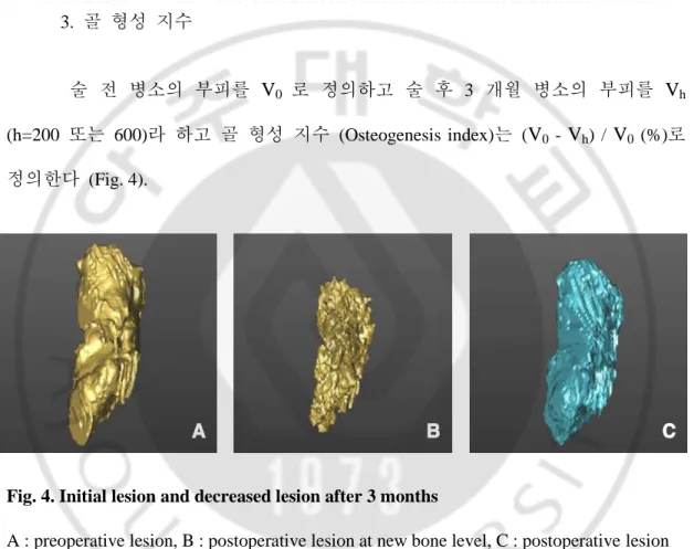 Fig. 3. Remodeling with 3D model 