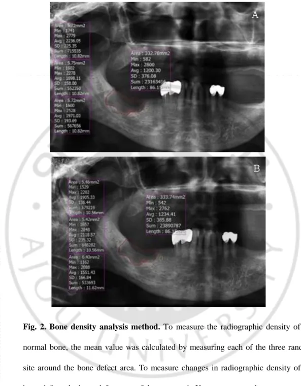Fig.  2.  Bone  density  analysis  method.  To  measure  the  radiographic  density  of  the  normal  bone,  the  mean  value  was calculated  by  measuring  each  of the three random  site  around  the  bone  defect  area