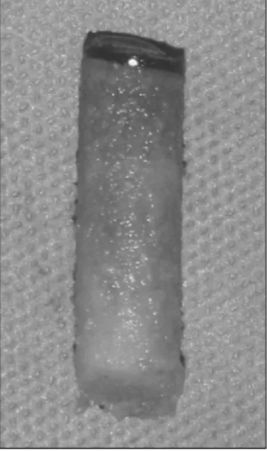 Fig  1.  Cored  bone  sample  of  primary  compressive  trabeculae  in  femoral  head.