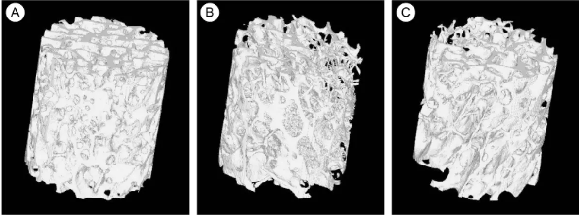 Fig.  3.  3D  reconstruction  in  bone  samples  from  2D  serial  micro-images.  (a)  M/20  (b)  M/51  (c)  F/51(Fig