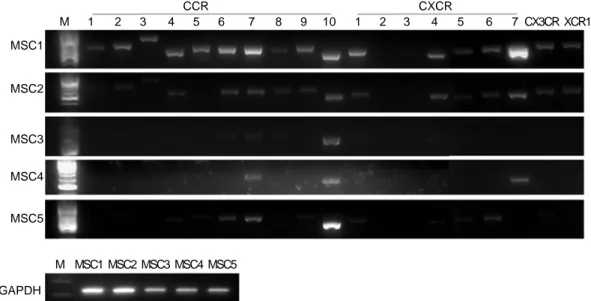 Fig.  1.  Gene  expression  of  chemokine  receptors  in  human  BMSCs.  This  is  the  result  of  RT-PCR  against  human  chemokine  receptors  using  cDNA  of  human  bMSCs