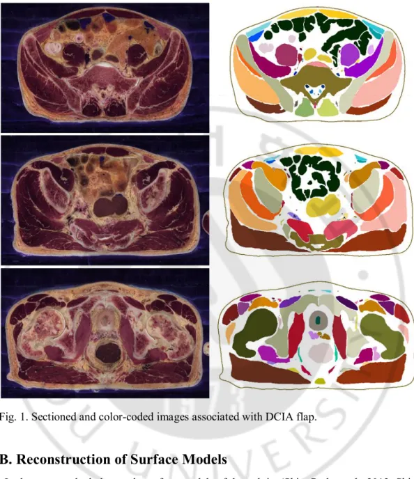 Fig. 1. Sectioned and color-coded images associated with DCIA flap. 