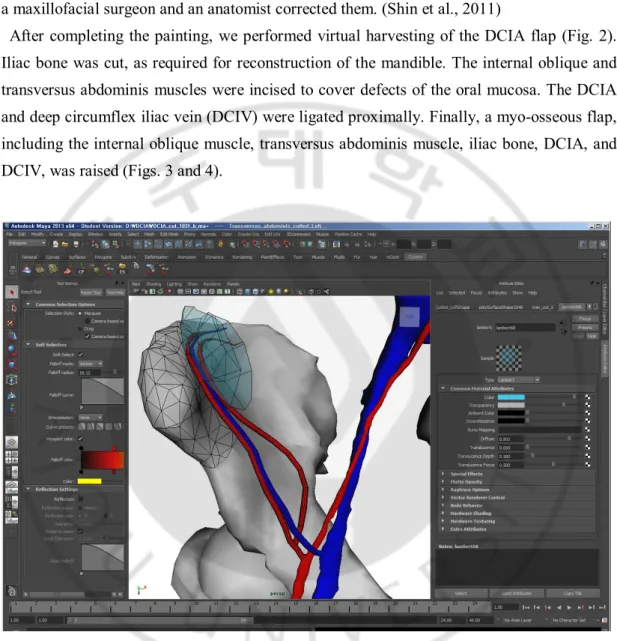 Fig. 2. Stereolithography files for making surface models of the virtual harvesting of the  DCIA flap on Maya software