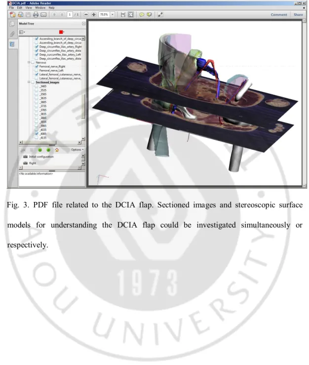 Fig.  3.  PDF  file  related  to  the  DCIA  flap.  Sectioned  images  and  stereoscopic  surface  models  for  understanding  the  DCIA  flap  could  be  investigated  simultaneously  or  respectively