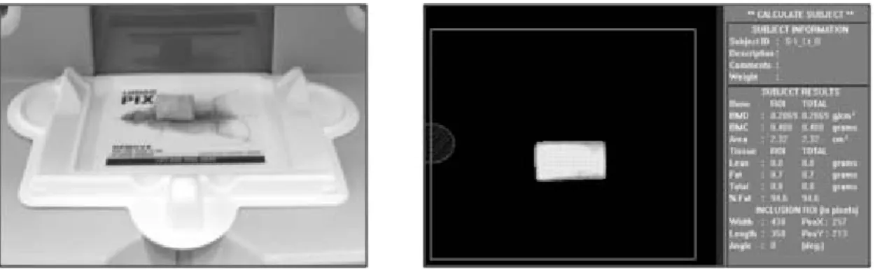 Fig.  2.  Scanning  of  the  bone  sample  using  the  PIXImus2  densitometry  (Lt)  and  total  region  of  interest  in  bone  sample  (Rt)
