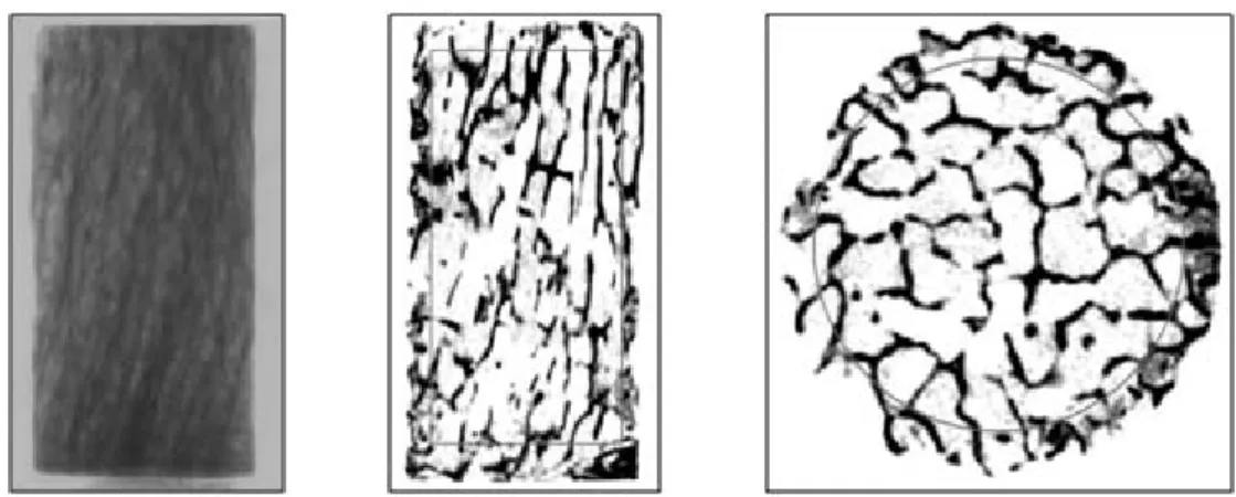 Fig.  3.  Two-dimensional  micro-images  of  the  bone  sample  (Lt:  X-ray  transmission  image,  Middle:  sagittal  image  and  Rt: 