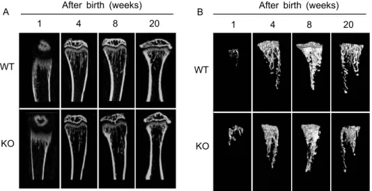 Fig.  3. Comparison  of  morphologies  of  vertical-sectional  (A)  and  3D  trabecular  images  (B)  between  WT  and  SHP  KO  mice  at  1,  4,  8,  20  weeks  aged