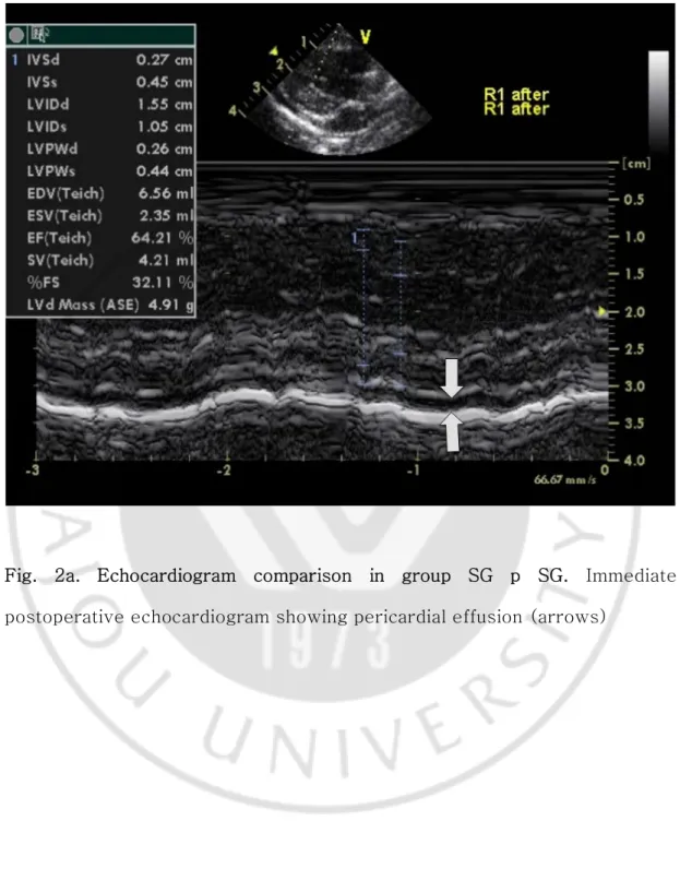 Fig.  2a.  Echocardiogram  comparison  in  group  SG  p  SG.  Immediate  postoperative echocardiogram showing pericardial effusion (arrows) 