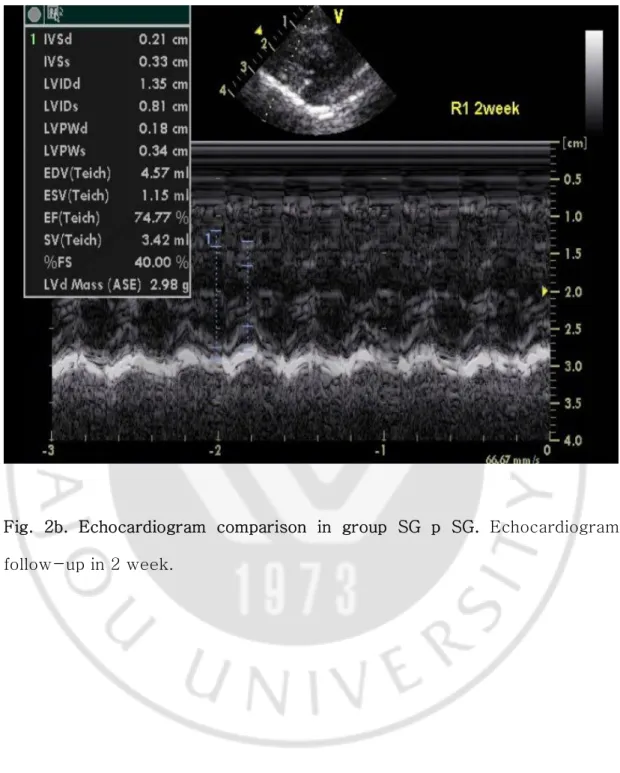 Fig.  2b.  Echocardiogram  comparison  in  group  SG  p  SG.  Echocardiogram  follow-up in 2 week