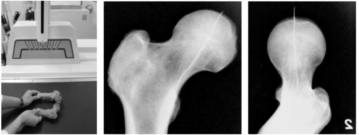 Fig. 2. Distinction of the primary compressive trabecular system by fluroscopy  제 1압박 골소주군 샘플은 지름이 20 ㎜ 인 원통형 톱(trephine bur) 및 탁상 용  드릴을  이용하여  제  1압박  골소주군의  전상부(superior  region)에서  후하부 (inferior  region)까지  관통하여  지름이  약  19  ㎜  인  원통형  샘플을  그림  3과  같이 