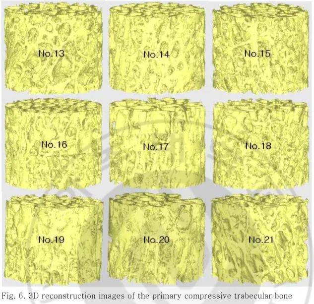 Fig. 6. 3D reconstruction images of the primary compressive trabecular bone 형태학적 지수(morphology index)는 ANT TM