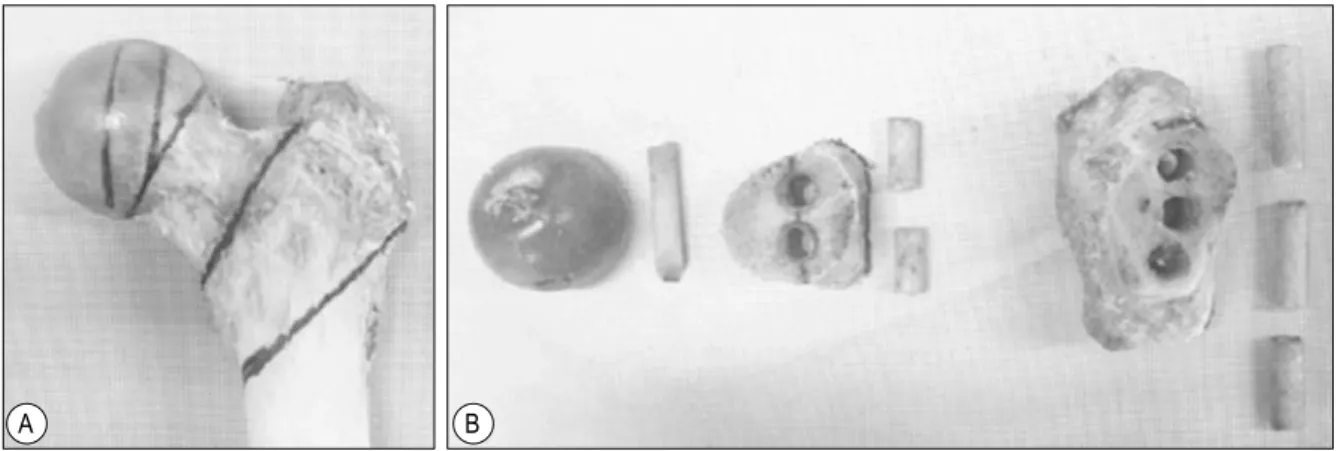 Fig.  2.  A-F:  Variations  in  3D  trabecular  microstructure  in  the  femoral  head  (A),  the  neck  superior  (B)  and  inferior  regions  (C),  and  the  trochanteric  superior  (D),  middle  (E)  and  inferior  regions  (F)  with  aging.