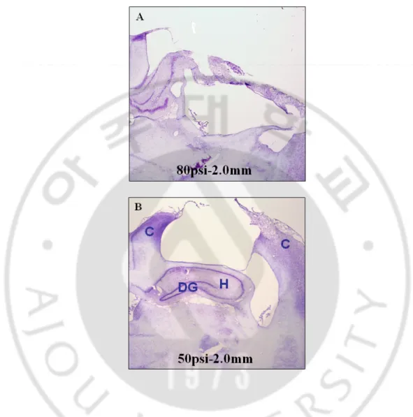 Fig. 4. Pathological findings (cresyl violet stain) showing the different magnitude of  brain injuries according to the different cortical impact pressure (velocity)