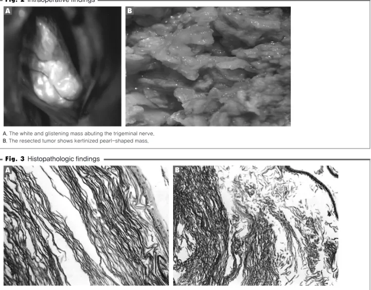 Fig. 2 Intraoperative findings