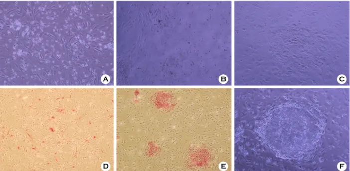 Figure 1. Colony formation of  single hESCs dissociated by Tryple. (A) single hESCs seeded on MEF  feeder layer (magnification  ×200), (B) early colony formation on day 7 after seeding (×200), (C) colony formation on day 14  after seeding (×200), (D) alkal