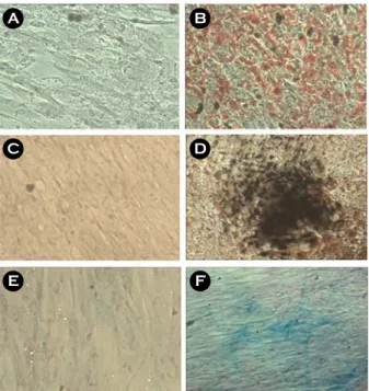 Figure 5. Adipogenic, osteogenic, and chondrogenic differentiation of HUC. HUC at p3 were cultured for 3 weeks in each differentiation medium specific to  adipo-genic (B), osteoadipo-genic (D) and chondroadipo-genic (F)