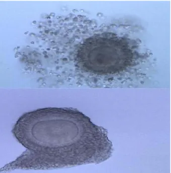 Table 1. Comparison of  morphologic characteristics between the matured and not matured oocytes  Matured 